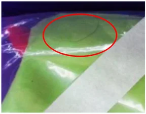 Hair inside a packaging bag. The circled strand is inside the packaging bag.